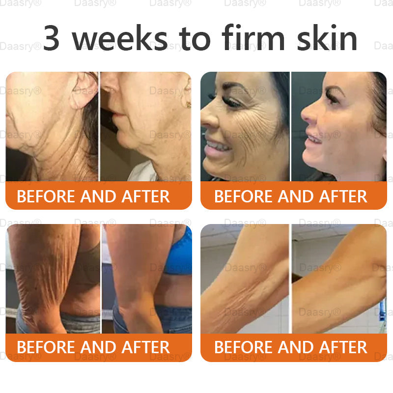 💎👨⚕️Tienda de Mayo Clinic y Cleveland Clinic: Hecho y enviado desde EE. UU. -✨ Natravor™ "Dermal Gold" Crema restauradora de la piel con veneno de abeja y botox - 🔥ÚLTIMO DÍA: 80 % DE DESCUENTO🔥