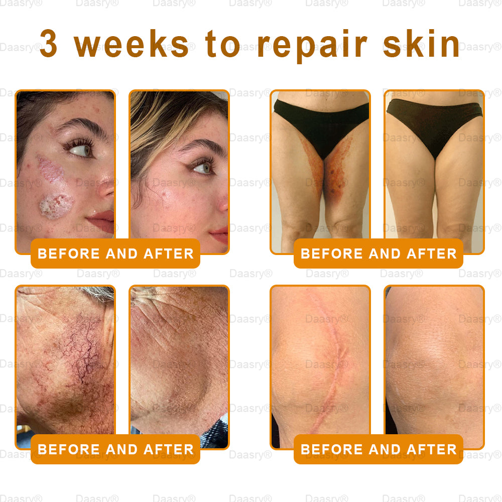 💎👨⚕️Tienda de Mayo Clinic y Cleveland Clinic: Hecho y enviado desde EE. UU. -✨ Natravor™ "Dermal Gold" Crema restauradora de la piel con veneno de abeja y botox - 🔥ÚLTIMO DÍA: 80 % DE DESCUENTO🔥