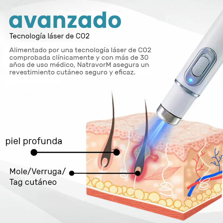 🏆Lápiz láser de grado médico Natravor™ 💕 (con tecnología láser de CO₂, elimina eficazmente lunares, verrugas, marcas en la piel, manchas de pigmentación y otras imperfecciones de la piel)