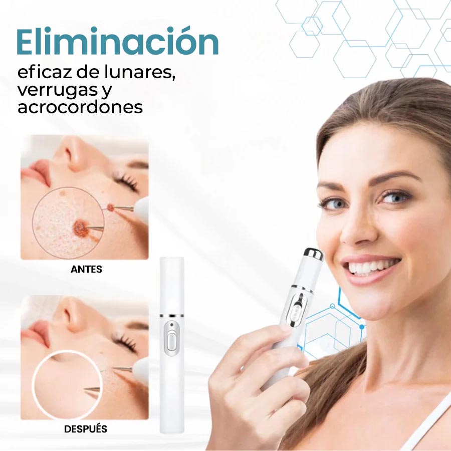 🏆Lápiz láser de grado médico Natravor™ 💕 (con tecnología láser de CO₂, elimina eficazmente lunares, verrugas, marcas en la piel, manchas de pigmentación y otras imperfecciones de la piel)