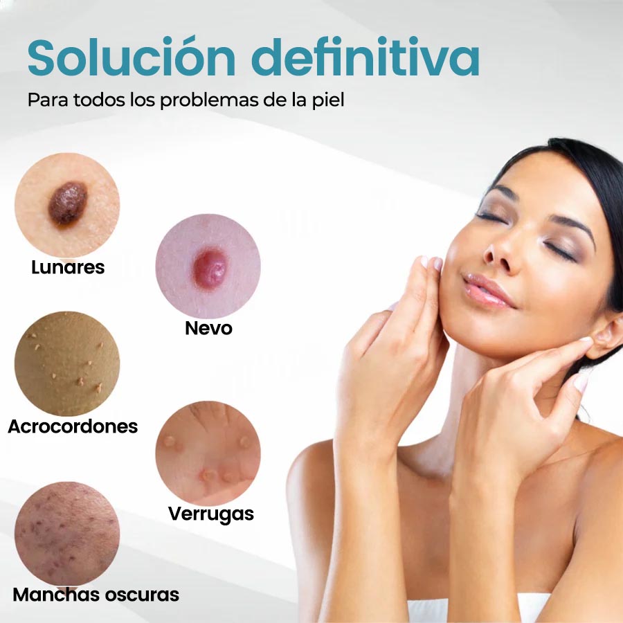 🏆Lápiz láser de grado médico Natravor™ 💕 (con tecnología láser de CO₂, elimina eficazmente lunares, verrugas, marcas en la piel, manchas de pigmentación y otras imperfecciones de la piel)