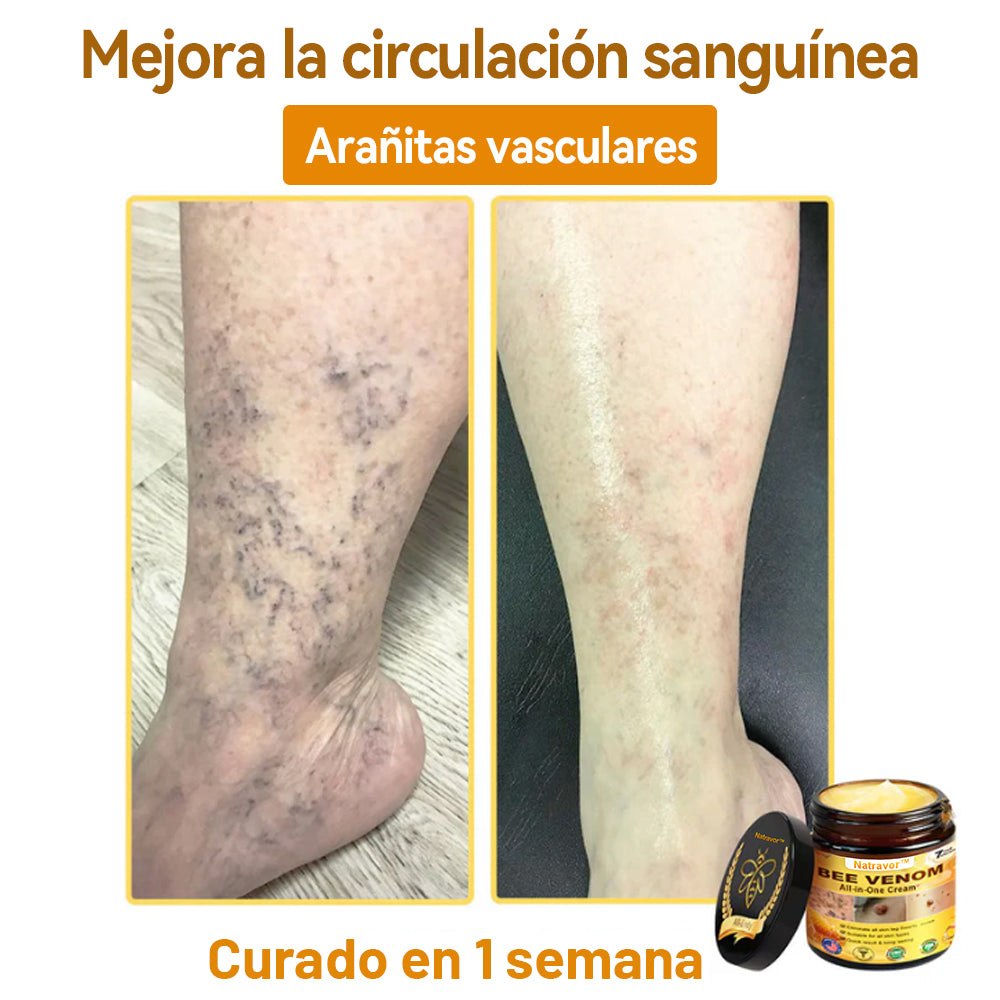 Natravor™ 🐝Crema todo en uno con veneno de abeja aprobada por dermatólogos en EE. UU.