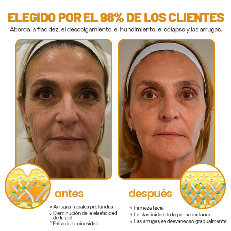 💎💐Hecho y enviado desde EE. UU. ✅Natravor™ Crema para eliminar arrugas con veneno de abeja y botox - Promoción de último día 70 % de descuento