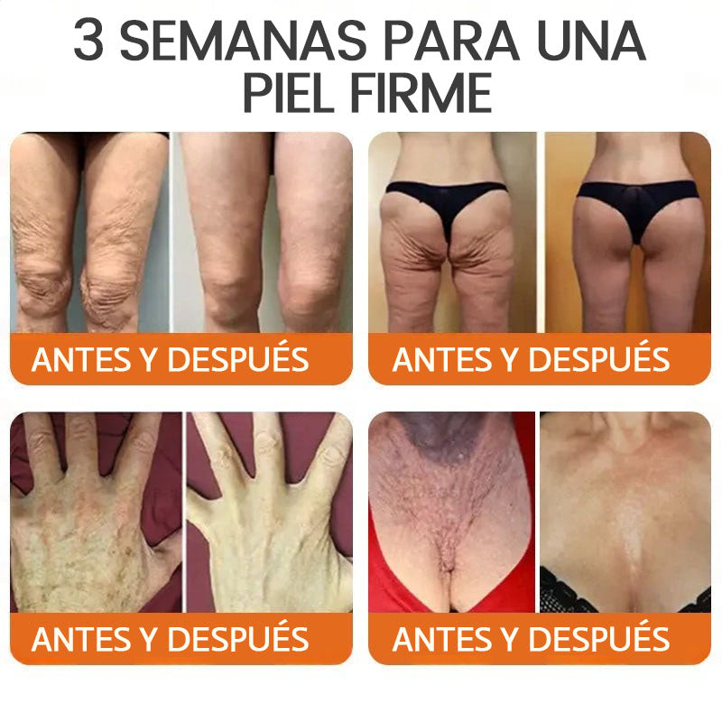 💎👨‍⚕️Hecho y enviado desde EE. UU. ✨Natravor™𝖢𝗋𝖾𝗆𝖺 𝖱𝖾𝗌𝗍𝖺𝗎𝗋𝖺𝖽𝗈𝗋𝖺 𝖽𝖾 𝖯𝗂𝖾𝗅 𝖼𝗈𝗇 𝖵𝖾𝗇𝖾𝗇𝗈 𝖽𝖾 𝖠𝖻𝖾𝗃𝖺