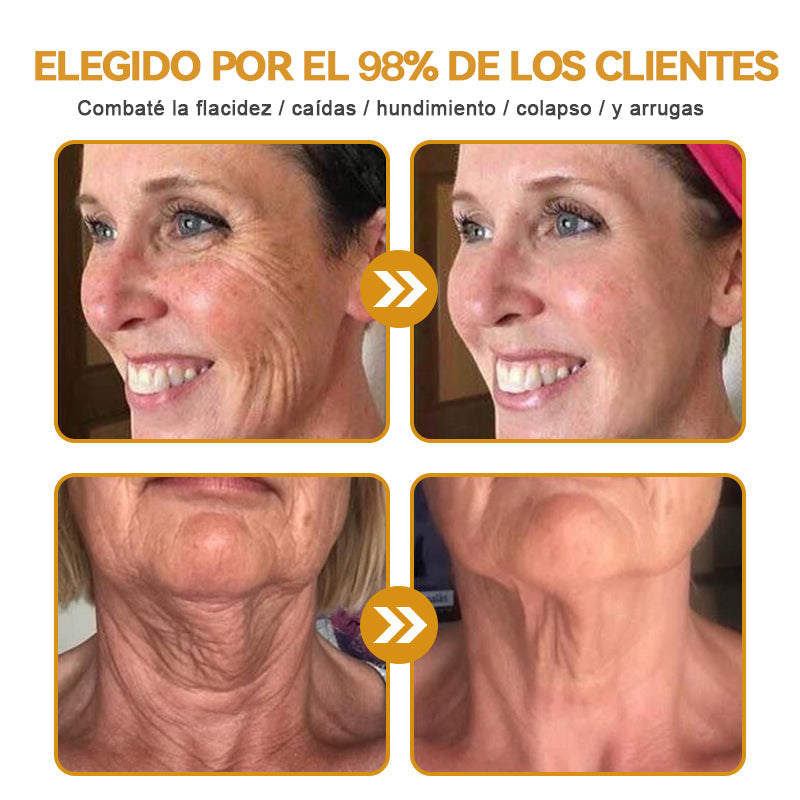 💎💐Hecho y enviado desde EE. UU. ✅Natravor™ Crema para eliminar arrugas con veneno de abeja y botox - Promoción de último día 70 % de descuento
