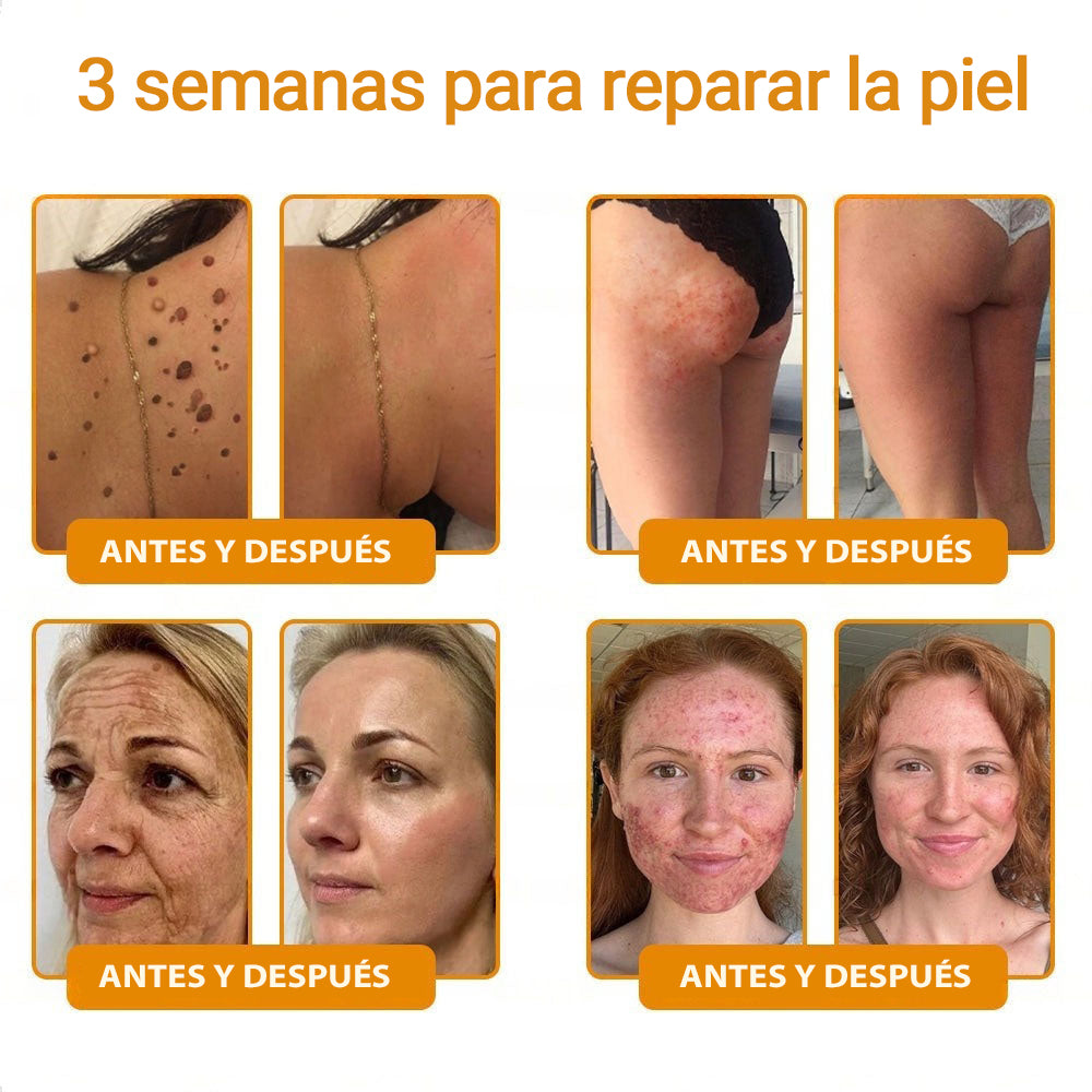 💎👨‍⚕️Hecho y enviado desde EE. UU. ✨Natravor™𝖢𝗋𝖾𝗆𝖺 𝖱𝖾𝗌𝗍𝖺𝗎𝗋𝖺𝖽𝗈𝗋𝖺 𝖽𝖾 𝖯𝗂𝖾𝗅 𝖼𝗈𝗇 𝖵𝖾𝗇𝖾𝗇𝗈 𝖽𝖾 𝖠𝖻𝖾𝗃𝖺
