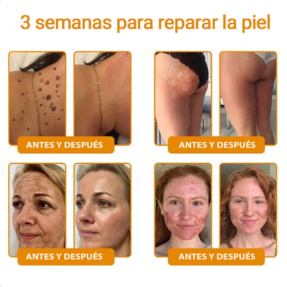 💎👨‍⚕️Hecho y enviado desde EE. UU. ✨Natravor™𝖢𝗋𝖾𝗆𝖺 𝖱𝖾𝗌𝗍𝖺𝗎𝗋𝖺𝖽𝗈𝗋𝖺 𝖽𝖾 𝖯𝗂𝖾𝗅 𝖼𝗈𝗇 𝖵𝖾𝗇𝖾𝗇𝗈 𝖽𝖾 𝖠𝖻𝖾𝗃𝖺