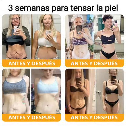 💎👨‍⚕️Hecho y enviado desde EE. UU. ✨Natravor™𝖢𝗋𝖾𝗆𝖺 𝖱𝖾𝗌𝗍𝖺𝗎𝗋𝖺𝖽𝗈𝗋𝖺 𝖽𝖾 𝖯𝗂𝖾𝗅 𝖼𝗈𝗇 𝖵𝖾𝗇𝖾𝗇𝗈 𝖽𝖾 𝖠𝖻𝖾𝗃𝖺