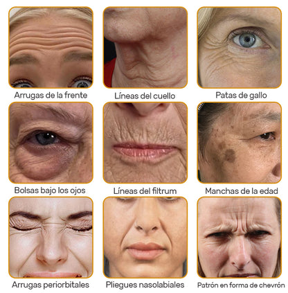 💎💐Hecho y enviado desde EE. UU. ✅Natravor™ Crema para eliminar arrugas con veneno de abeja y botox - Promoción de último día 70 % de descuento