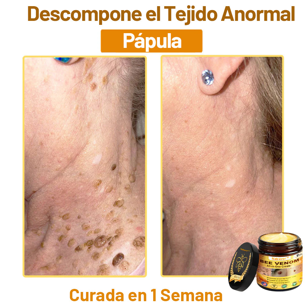 Natravor™ 🐝Crema todo en uno con veneno de abeja aprobada por dermatólogos en EE. UU.