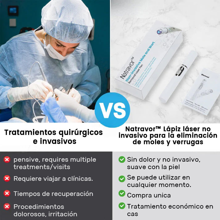 🏆Lápiz láser de grado médico Ｎatravor™ 💕 (con tecnología láser de CO₂, elimina eficazmente lunares, verrugas, marcas en la piel, manchas de pigmentación y otras imperfecciones de la piel)