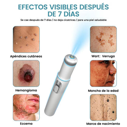 🏆Lápiz láser de grado médico Ｎatravor™ 💕 (con tecnología láser de CO₂, elimina eficazmente lunares, verrugas, marcas en la piel, manchas de pigmentación y otras imperfecciones de la piel)