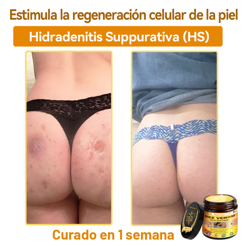 Natravor™ 🐝Crema todo en uno con veneno de abeja aprobada por dermatólogos en EE. UU.