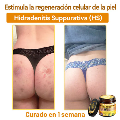 Natravor™ 🐝Crema todo en uno con veneno de abeja aprobada por dermatólogos en EE. UU.