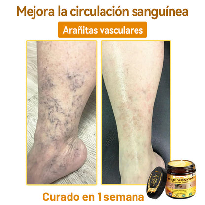 Natravor™ 🐝Crema todo en uno con veneno de abeja aprobada por dermatólogos en EE. UU.