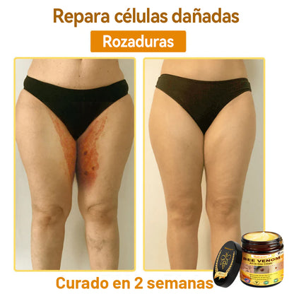 Natravor™ 🐝Crema todo en uno con veneno de abeja aprobada por dermatólogos en EE. UU.