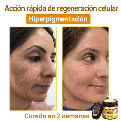 Natravor™ 🐝Crema todo en uno con veneno de abeja aprobada por dermatólogos en EE. UU.