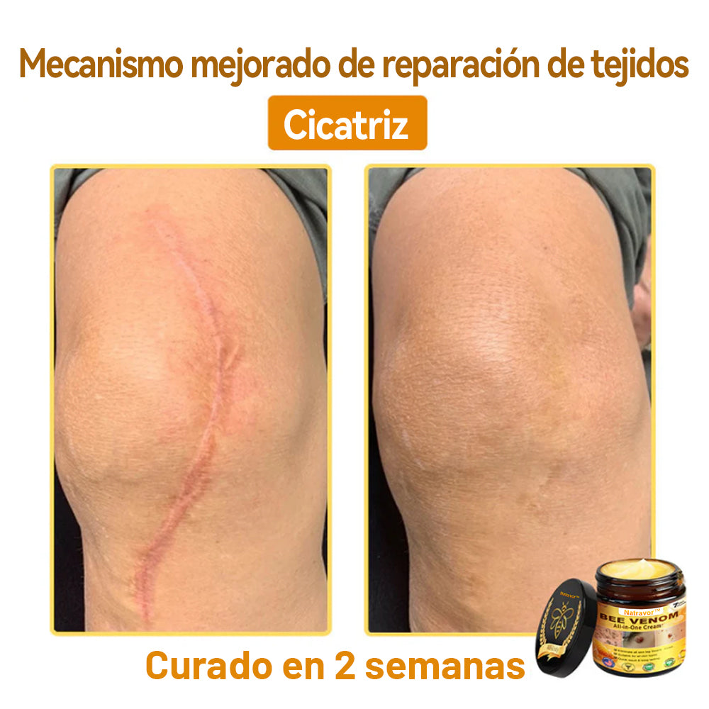 Natravor™ 🐝Crema todo en uno con veneno de abeja aprobada por dermatólogos en EE. UU.