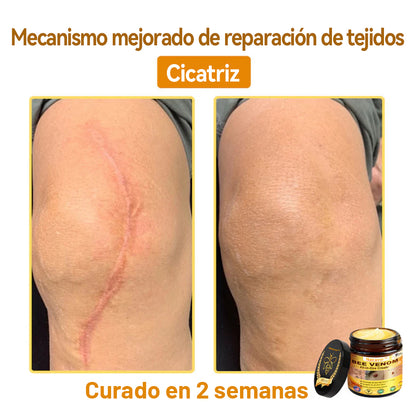 Natravor™ 🐝Crema todo en uno con veneno de abeja aprobada por dermatólogos en EE. UU.
