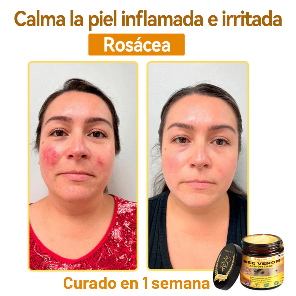 Natravor™ 🐝Crema todo en uno con veneno de abeja aprobada por dermatólogos en EE. UU.